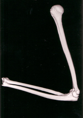 Hinge joints uzopedia